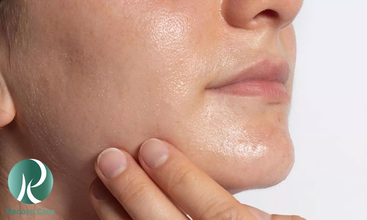 محصولات مراقبتی پوست چرب محصولات مناسب برای پوست چرب