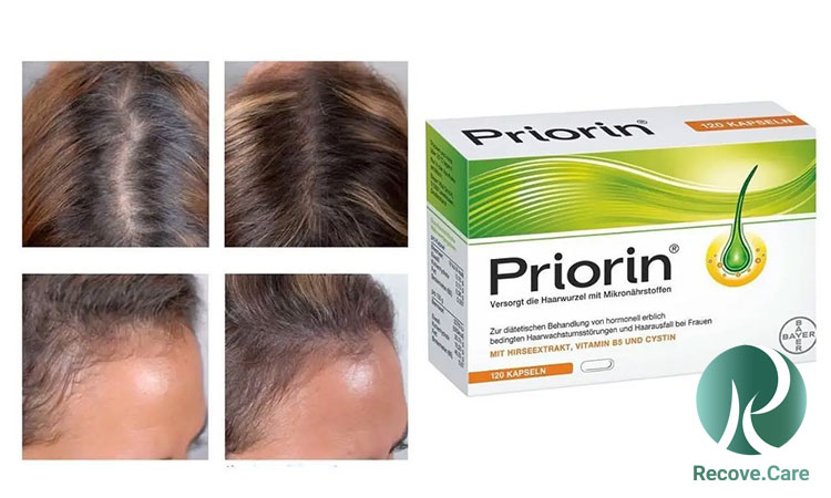 معرفی قرص پریورین قرص پریورین